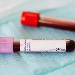 Iron Studies Test: What it Measures and Why it is Important
